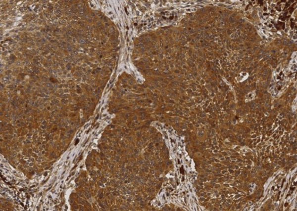Recombinant NME1/NDKA Monoclonal Antibody (AN300067P)