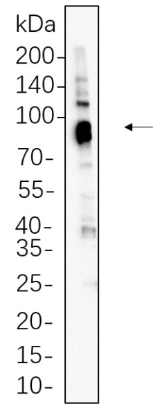 Recombinant MDM2 Monoclonal Antibody (AN300707L)