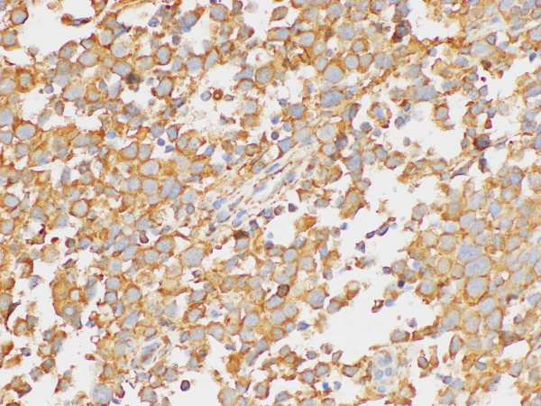 PAIP1 Polyclonal Antibody (E-AB-40457)