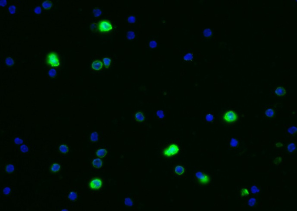 Recombinant CEACAM1/CD66a Monoclonal Antibody (AN300535P)