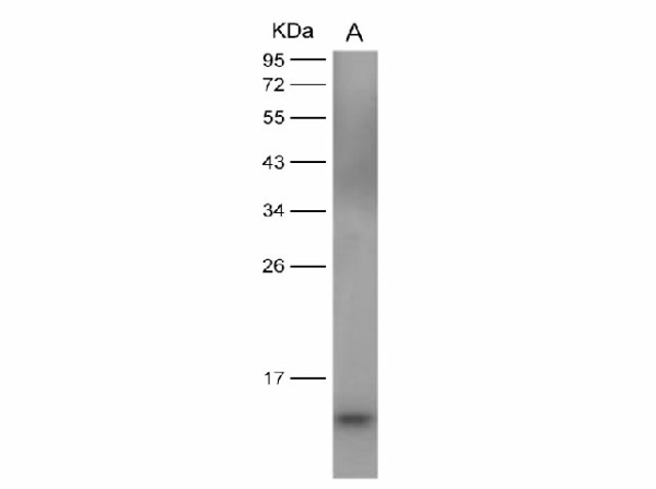 Anti-Dengue virus DENV-2(Strain New Guinea C/PUO-218 hybrid) E/Envelope Protein(Domain III) Monoclonal Antibody (E-AB-V1072)