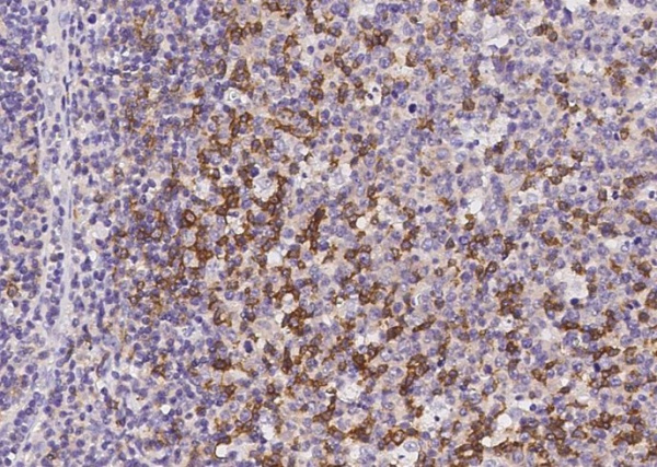 PD1/PDCD1/CD279 Monoclonal Antibody (AN200174P)