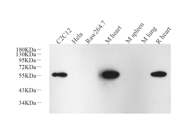 Desmin Monoclonal Antibody (E-AB-70228)