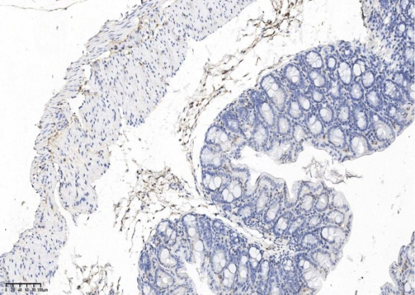 Recombinant PDGF alpha receptor/PDGFRA Monoclonal Antibody (AN300575P)