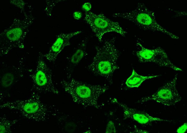 Recombinant PPM1G Monoclonal Antibody (AN300229P)