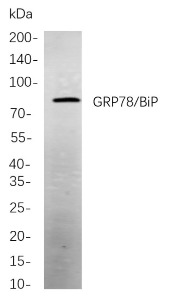 Recombinant GRP78/BiP Monoclonal Antibody (AN300971L)