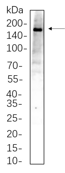 Recombinant TBC1D4 Monoclonal Antibody (AN300720L)