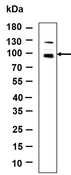 Recombinant Nibrin Monoclonal Antibody (AN301138L)