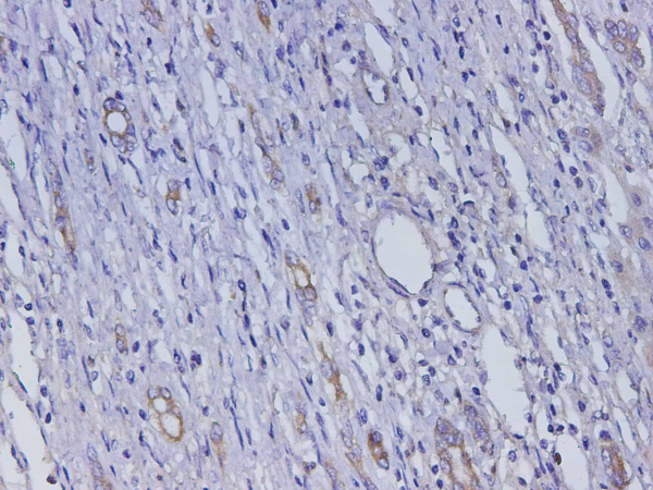 AFP Polyclonal Antibody (D-AB-10366L)