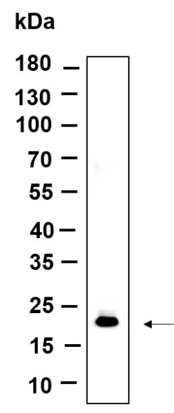 Recombinant Histone H3 (Di Methyl Lys79) Monoclonal Antibody (AN301181L)