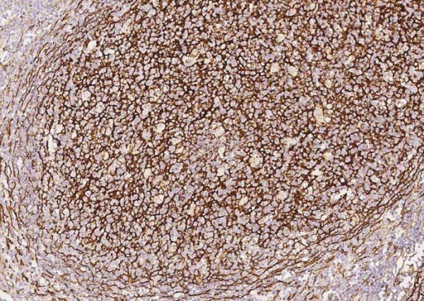 VCAM1/VCAM-1/CD106 Monoclonal Antibody (AN200166P)