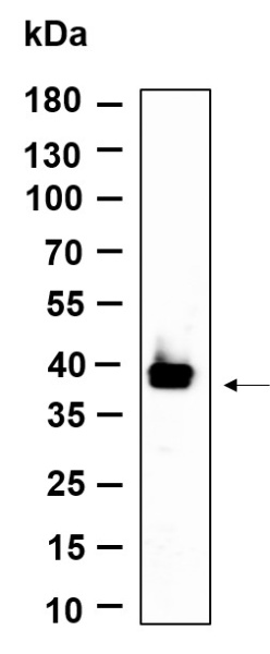 Recombinant dbx2 Monoclonal Antibody (AN301211L)