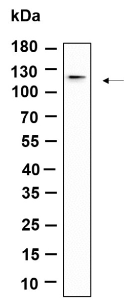 Recombinant DDR1 Monoclonal Antibody (AN301396L)