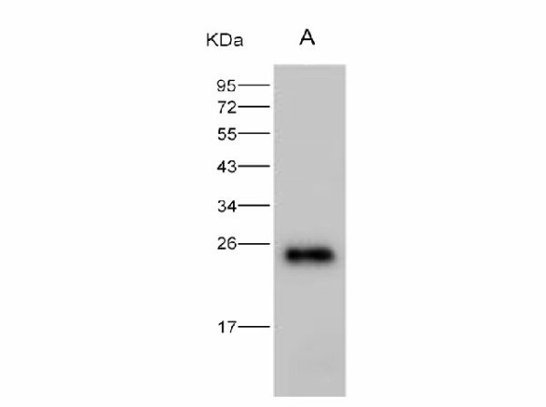 Anti-HIV-1 p24 Protein(group M, subtype B, strain 92418) Polyclonal Antibody (E-AB-V1221)