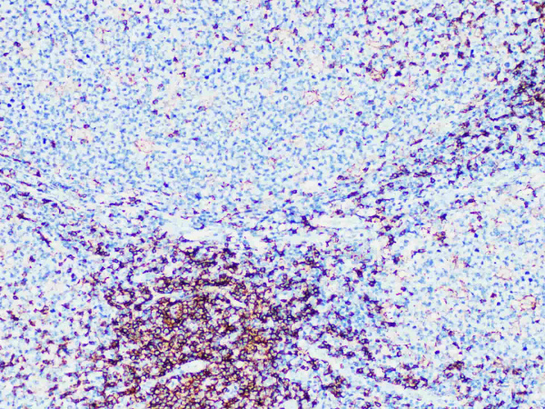 CD4 Monoclonal Antibody (ELAB6716-R)