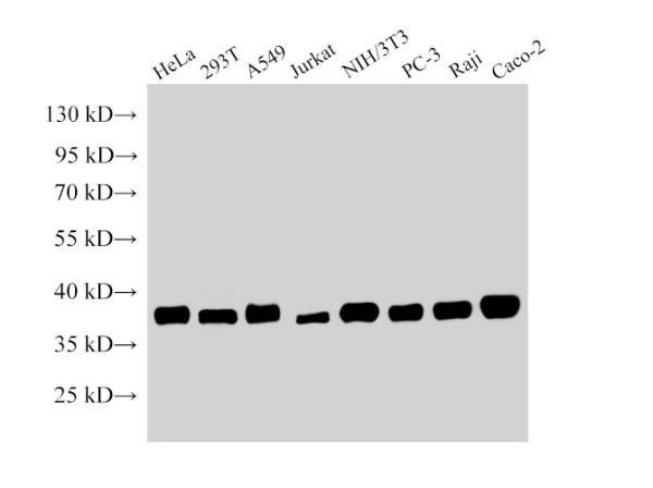 NPM1 Polyclonal Antibody (E-AB-40477)