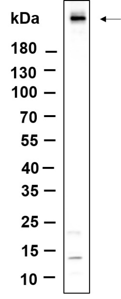 Recombinant Phospho-ATM (Ser1981) Monoclonal Antibody (AN301139L)