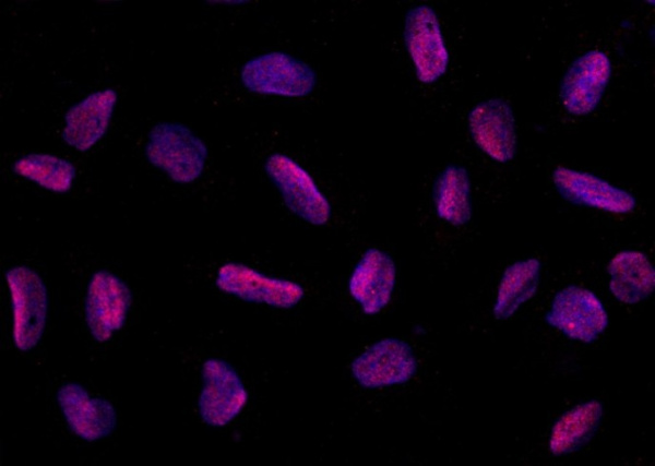 Recombinant PPIL2 Monoclonal Antibody (AN300130P)