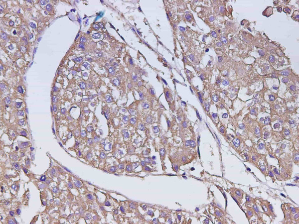 AFP Polyclonal Antibody (D-AB-10223L)