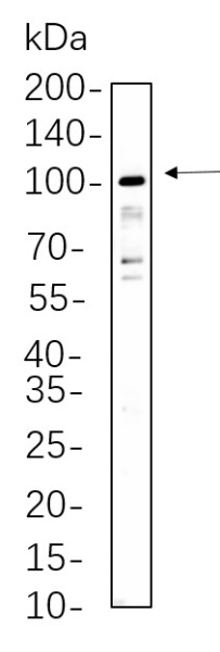 Recombinant STAT5A/B Monoclonal Antibody (AN300816L)