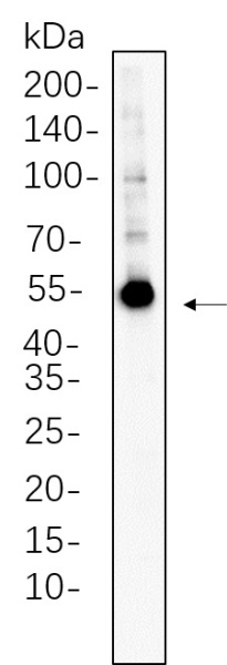 Recombinant Fascin Monoclonal Antibody (AN300598L)