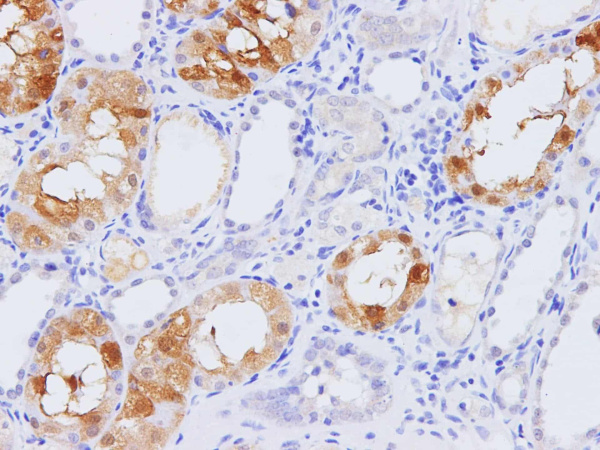 PCK1 Polyclonal Antibody (D-AB-10224L)