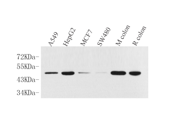 CK-18 Polyclonal Antibody (E-AB-70095)