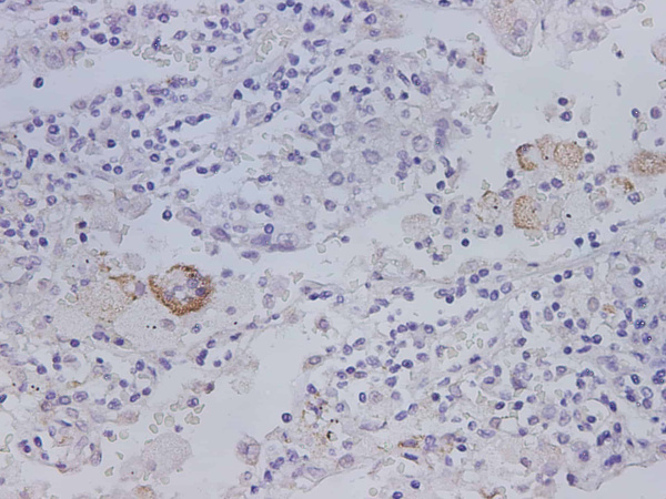 MMP-1 Polyclonal Antibody (D-AB-10373L)