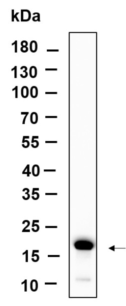 Recombinant Histone H3 (Tri Methyl Lys79) Monoclonal Antibody (AN301160L)