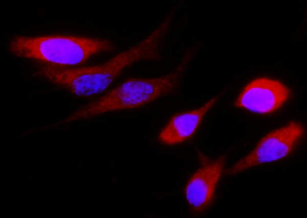 Recombinant Cystatin S/CST4 Monoclonal Antibody (AN300402P)