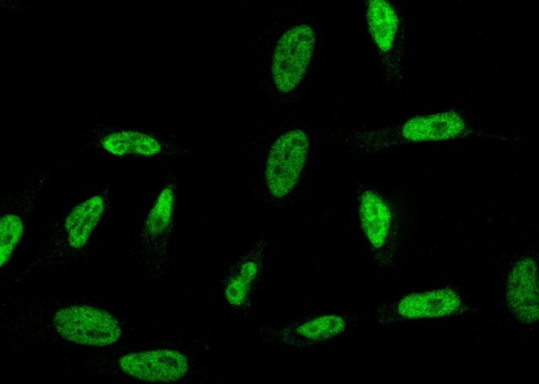 RPRD1B Monoclonal Antibody (AN200235P)