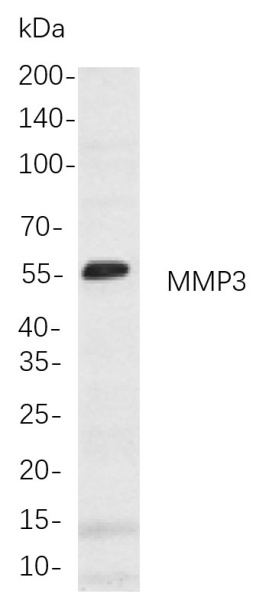 Recombinant MMP3 Monoclonal Antibody (AN301020L)