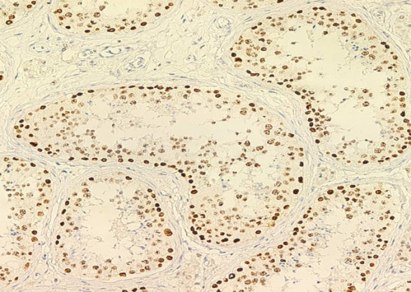 PARP/PARP1 Monoclonal Antibody (AN200247P)