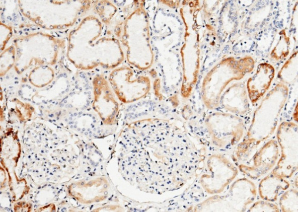 Recombinant TFPI Monoclonal Antibody (AN300197P)