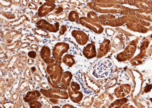 Recombinant CNDP2 Monoclonal Antibody (AN300497P)