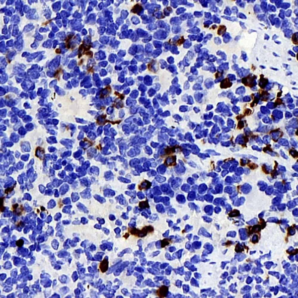 P2RX3 Polyclonal Antibody (E-AB-70216)
