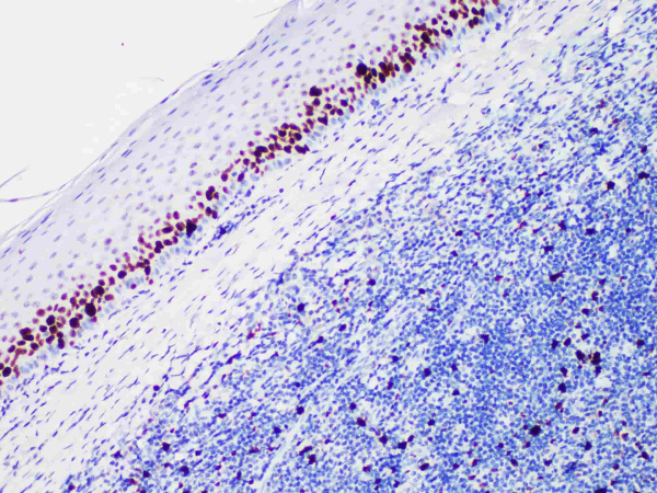 Ki-67 Monoclonal Antibody (ELAB6189-R)