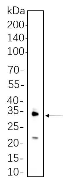 Recombinant IL-1 β Monoclonal Antibody (AN300677L)