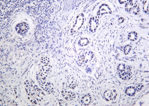 Recombinant THOC1 Monoclonal Antibody (AN301248L)