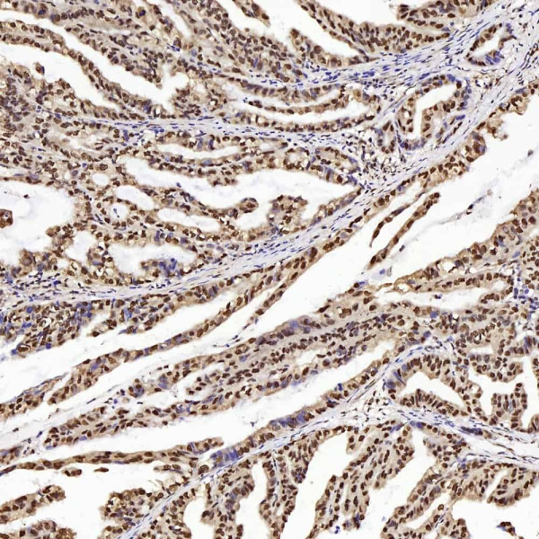 PTEN Polyclonal Antibody (E-AB-70070)
