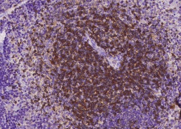 Recombinant CD27/TNFRSF7 Monoclonal Antibody (AN300477P)