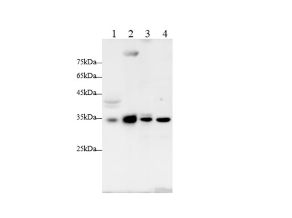 CCND1 Polyclonal Antibody (AN006770L)