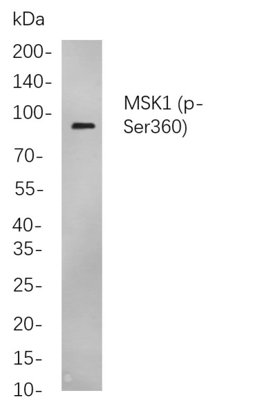 Recombinant Phospho-MSK1 (Ser360) Monoclonal Antibody (AN301016L)