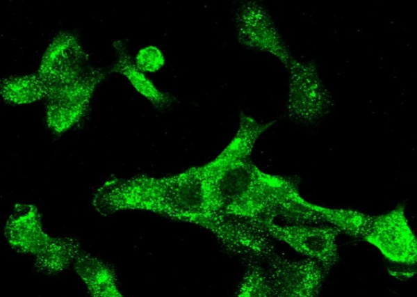 Recombinant Cytokeratin 5/KRT5 Monoclonal Antibody (AN300108P)