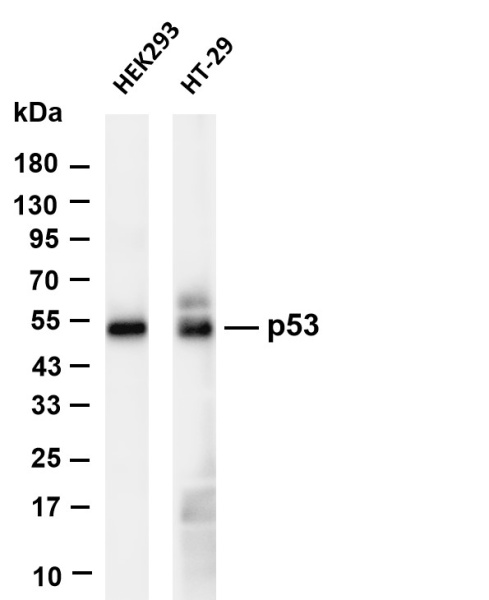 Recombinant p53 Monoclonal Antibody (AN301337L)
