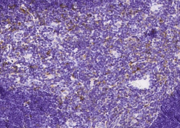 Recombinant CD180/RP105 Monoclonal Antibody (AN300524P)