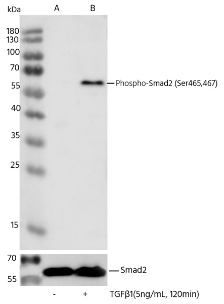 Recombinant Phospho-SMAD2 (Ser465, 467) Monoclonal Antibody (AN300146L)