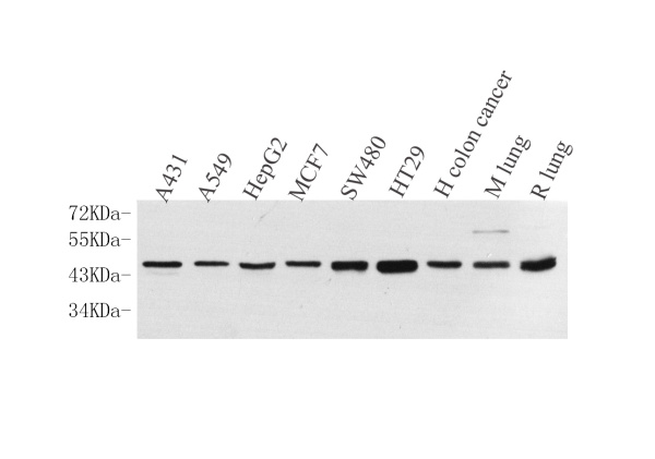 CK-19 Polyclonal Antibody (E-AB-70083)