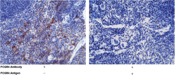 Recombinant CD16-2/FCGR4 Monoclonal Antibody (AN300461P)