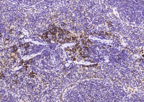 Recombinant MAP2 Monoclonal Antibody (AN300528P)
